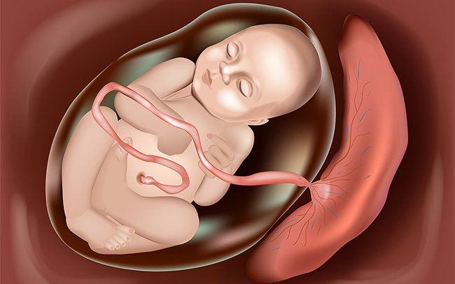 Illustration of baby in the womb with the placenta implanted abnormally into the womb wall