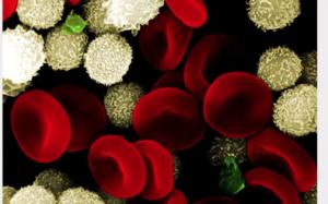 Sepsis infection particles under a microscope